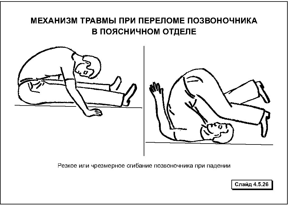 Ушиб спины помощь