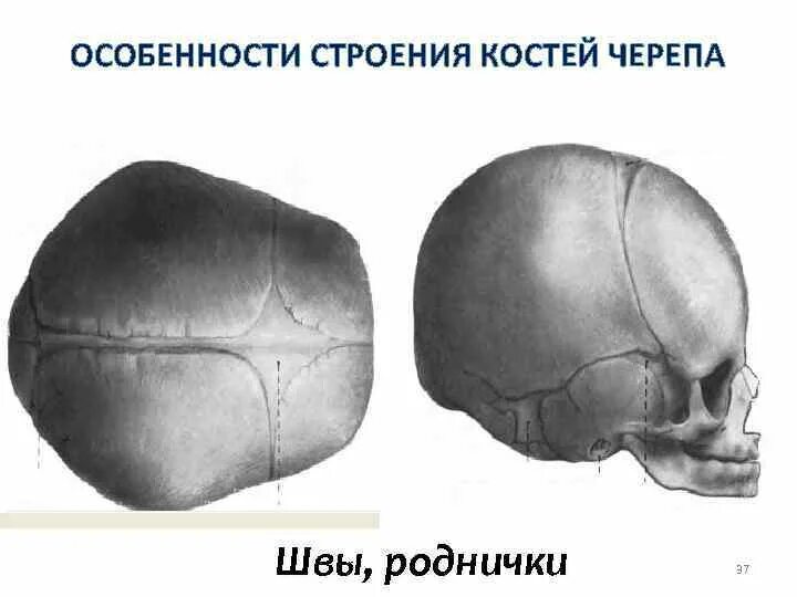 Швы на черепе ребенка. Швы на черепе ребенка