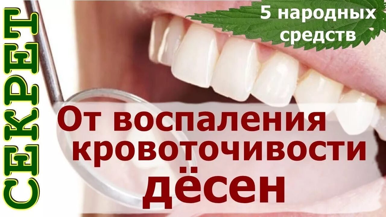 Полоскание для десен. Полоскание при кровоточивости десен. Травяное полоскание для десен. Лесной бальзам ополаскиватель при кровоточивости десен. Полоскание для десен при воспалении.