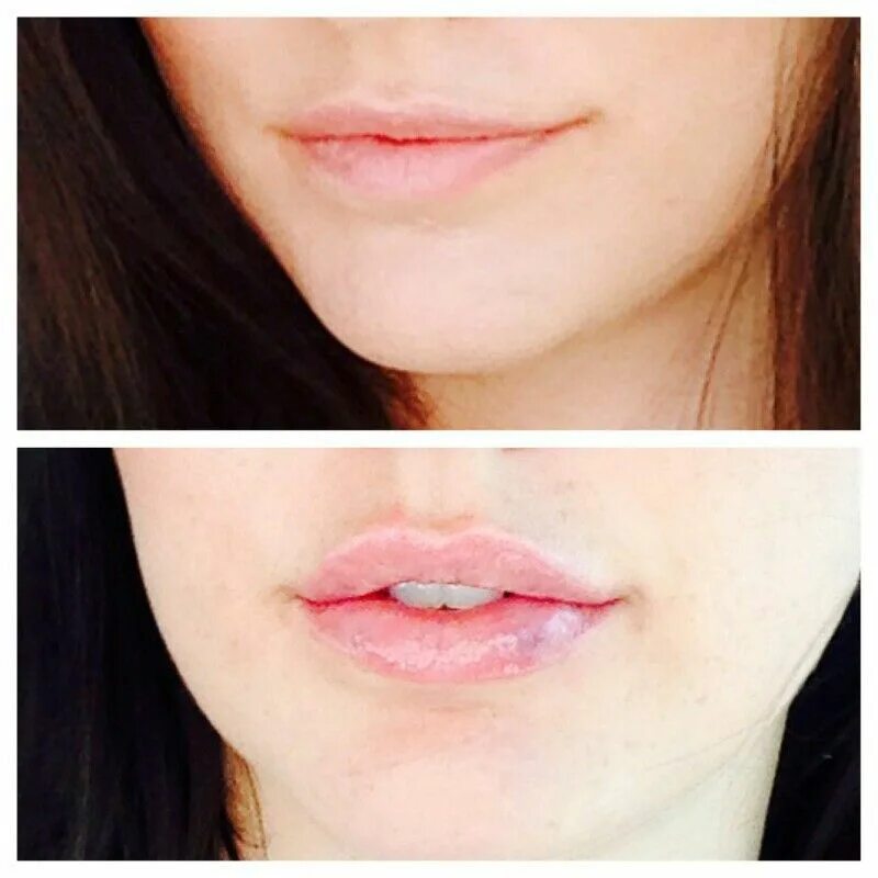 Форма губ бант. Тонкая форма губ. заостренная форма губ. красивая форма тонких губ.