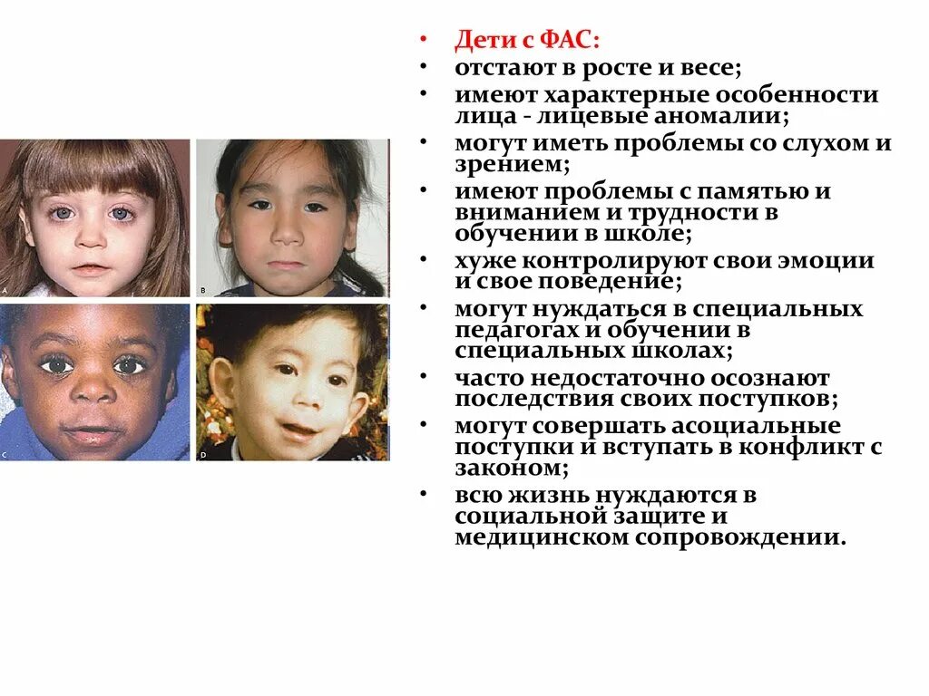 синдром смирения. специфический симптом фенилкетонурия. фенилкетонурия это наследственное заболевание. синдром спящей красавицы. синдром вильямса что это такое у детей.