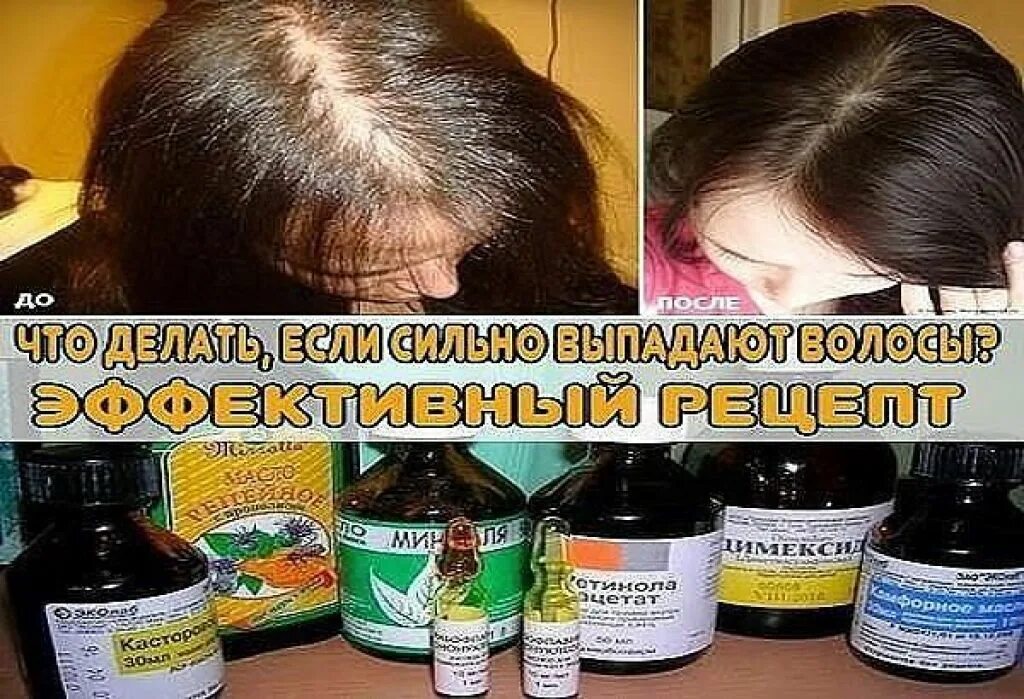 Сильно упала что делать. Что сделать что бы волрсы не выпадывали. препараты для падения волос.