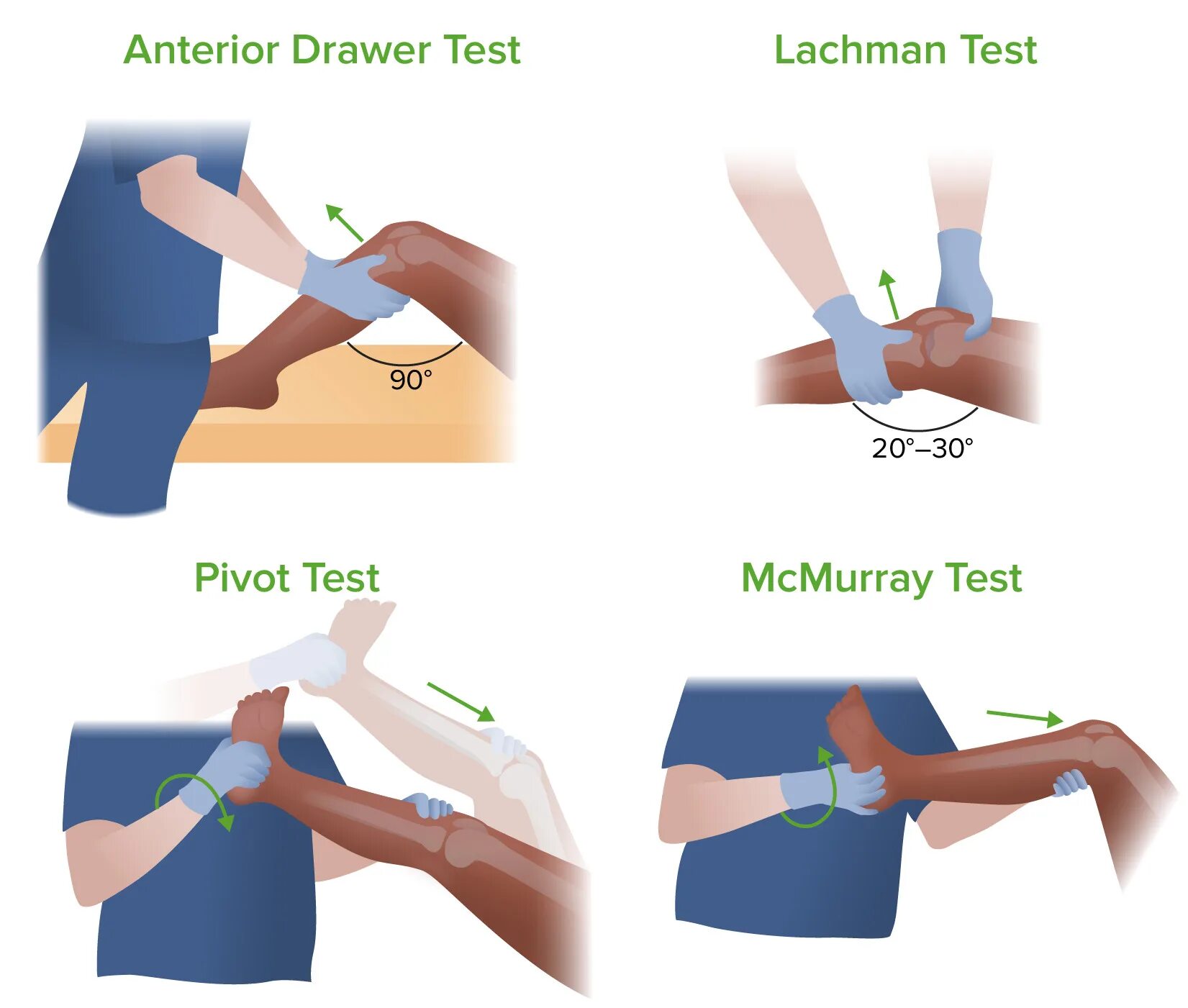 Тест Лахмана коленного. Тест Pivot Shift коленного сустава. Тесты на коленный сустав