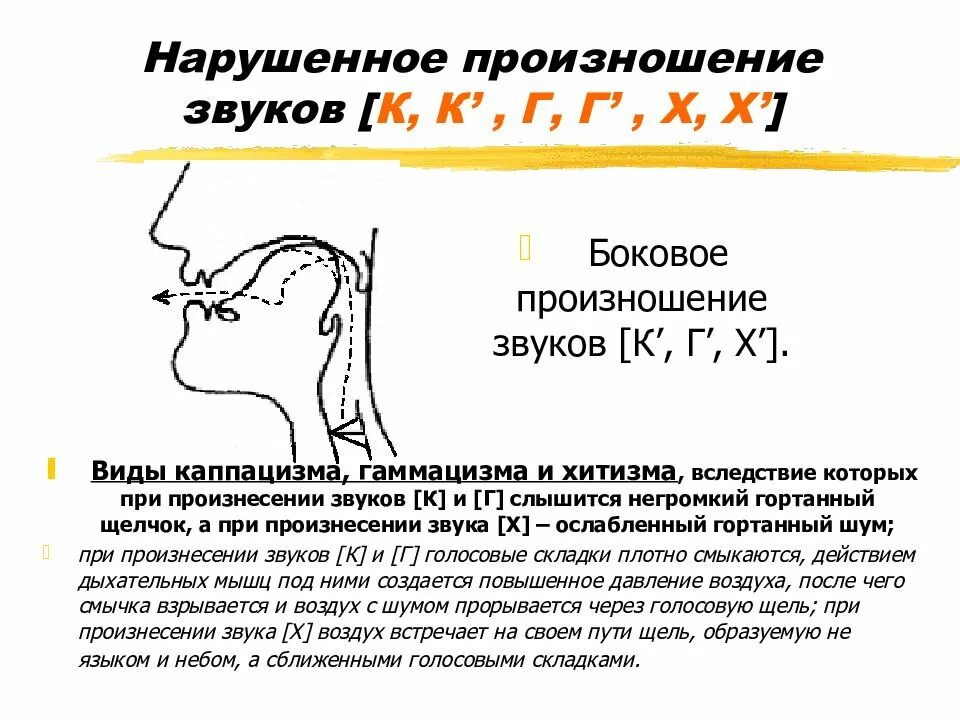 Произношение отдельных звуков. Произношение звуков. Постановка звука г. Боковое произношение звука. Неправильное произношение звуков.