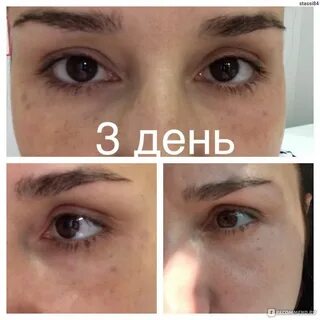 Реви под глаза