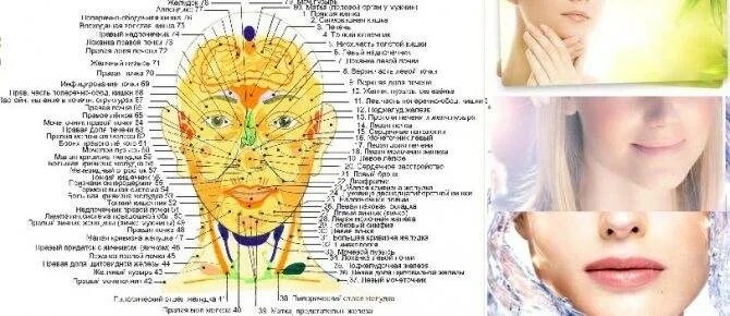 Прыщи какой орган страдает. Угревая сыпь на лице по зонам. Прыщи на лице причины по зонам у женщин. Карта прыщей на лице у женщин. Прыщи на лице по зонам причины.