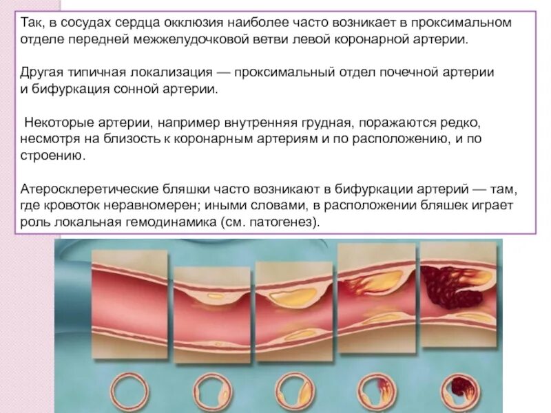Симптомы зажатых сосудов