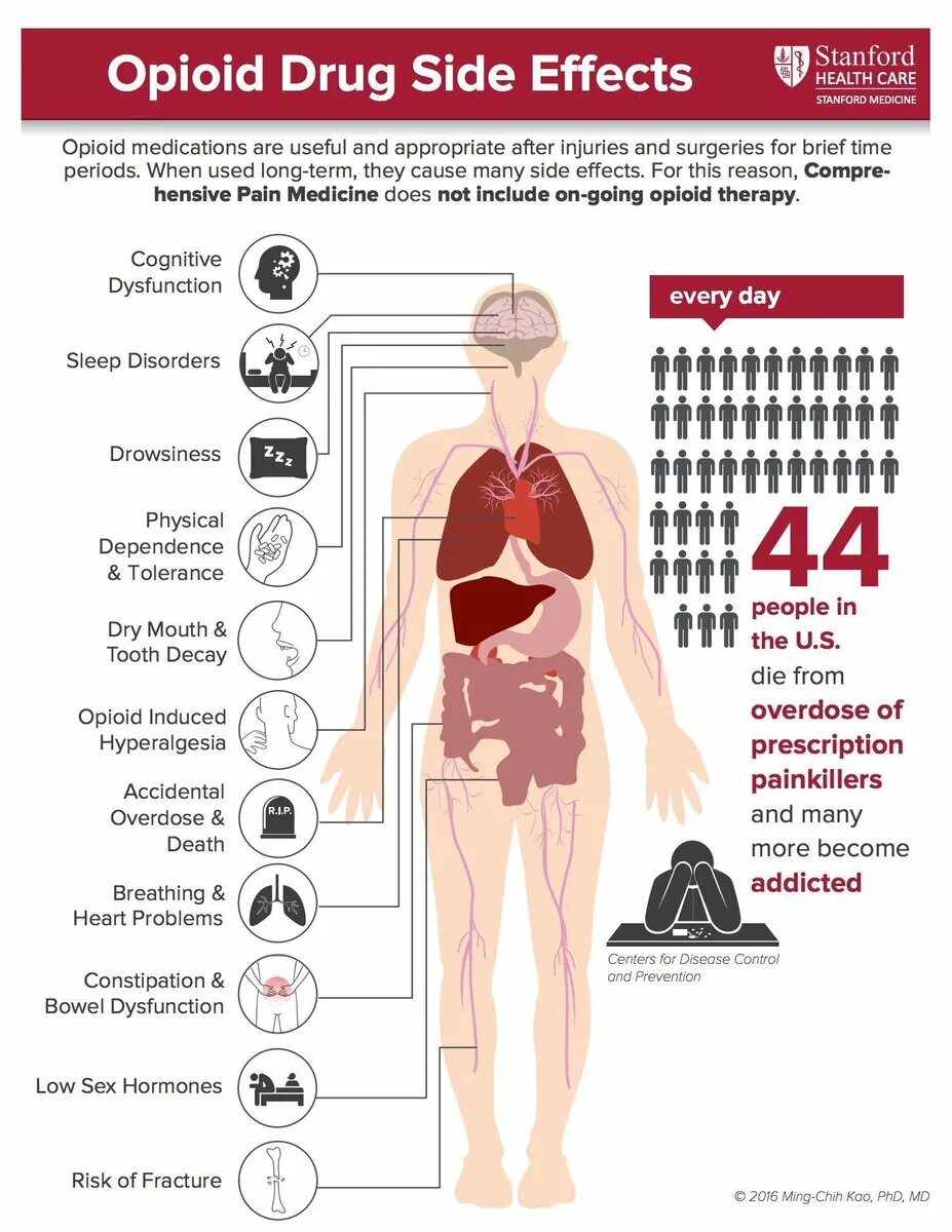 Health risks. Opioid Side Effects. Side Effects of Medicine.