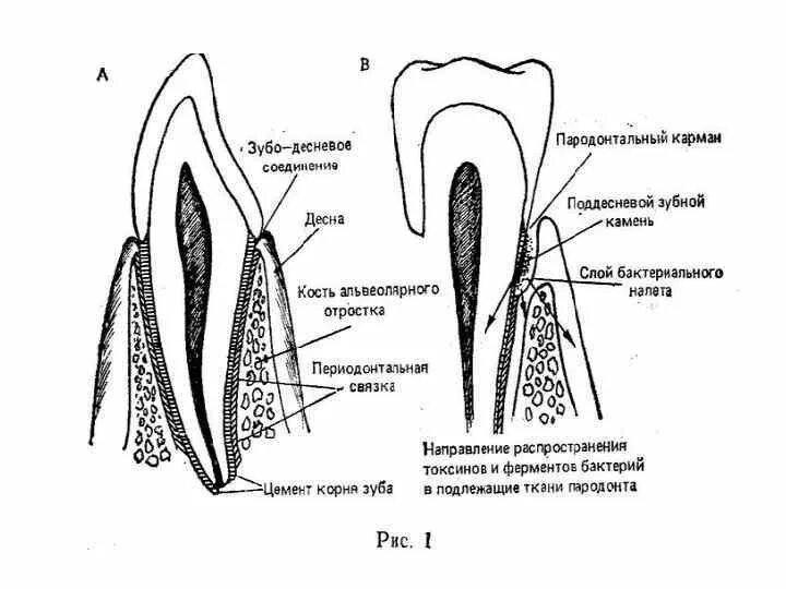 Комплекс тканей пародонта. Периодонт временных зубов схема. Коллагеновые волокна периодонта.