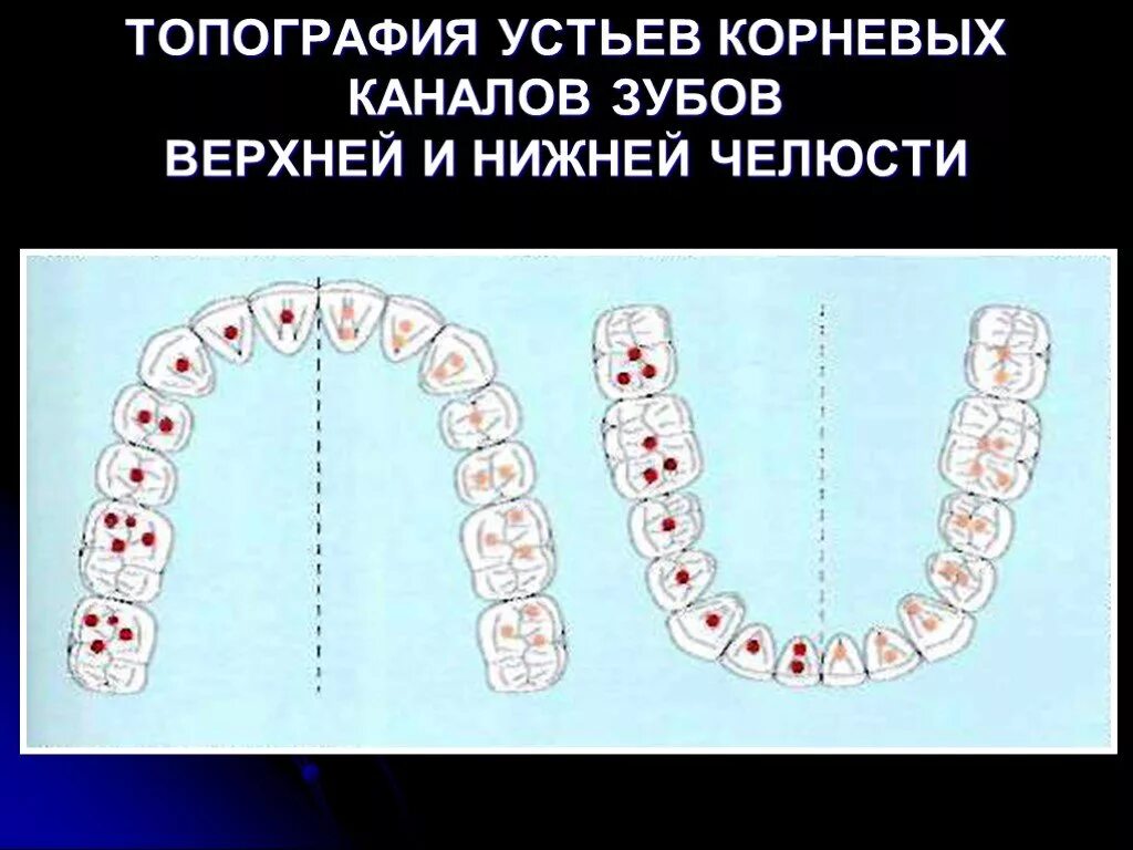 Устье корневых каналов зубов верхней и нижней челюсти. Корневые каналы зубов схема. Анатомия устьев корневых каналов 26 зуба.