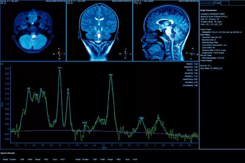 Потенциал ээг. Когнитивные вызванные потенциалы метод. Методика регистрации вызванных потенциалов. Вызванные потенциалы коры головного мозга. Метод вызванных потенциалов головного мозга.