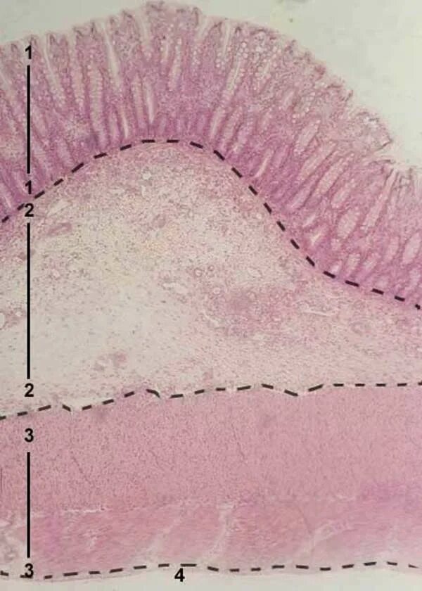 Ткани толстой кишки. Толстая кишка гистология препарат. Эпителий Толстого кишечника гистология. Препарат Толстого кишечника гистология. Толстый кишечник гистология препарат.