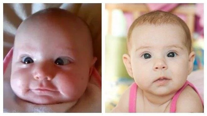 Страбизм у новорожденных. Раскосые глаза у новорожденного. Глаза новорожденного ребенка. Глаза новорожденного. Темно серые глаза у новорожденного.