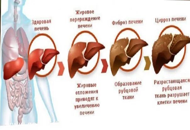 Кровь через печень. Очищение крови печенью. Обновление клеток печени.