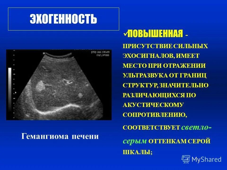 Эхогенность поджелудочной железы повышена что это такое. Повышенная эхогенность поджелудочной железы что это такое. Гиперэхогенный очаг в поджелудочной железе. Повышена эхогенность поджелудочной железы на УЗИ. Диффузно неоднородная повышенной эхогенности