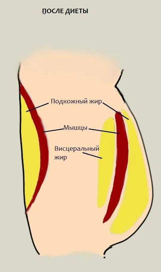 Как выглядит подкожный жир. Подкожный и висцеральный жир. Сжигание подкожного