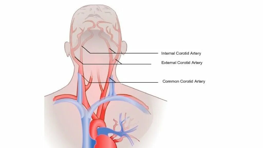 Сонная артерия где находится. Где находится Сонная артерия у человека. Сонные артерии на шее фото. Сонная артерия как нащупать где