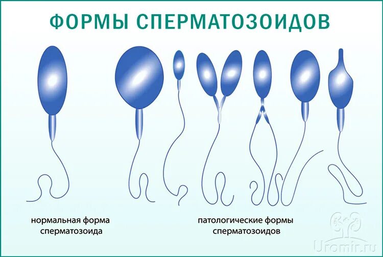 Сперма Вяло Вытекает