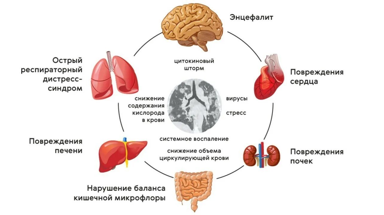 Тяжело после ковид. Постковидныцй синдром. Постковаидный синдром. Потсковидный синдром симптомы. Постковтдный синдром симптомы.