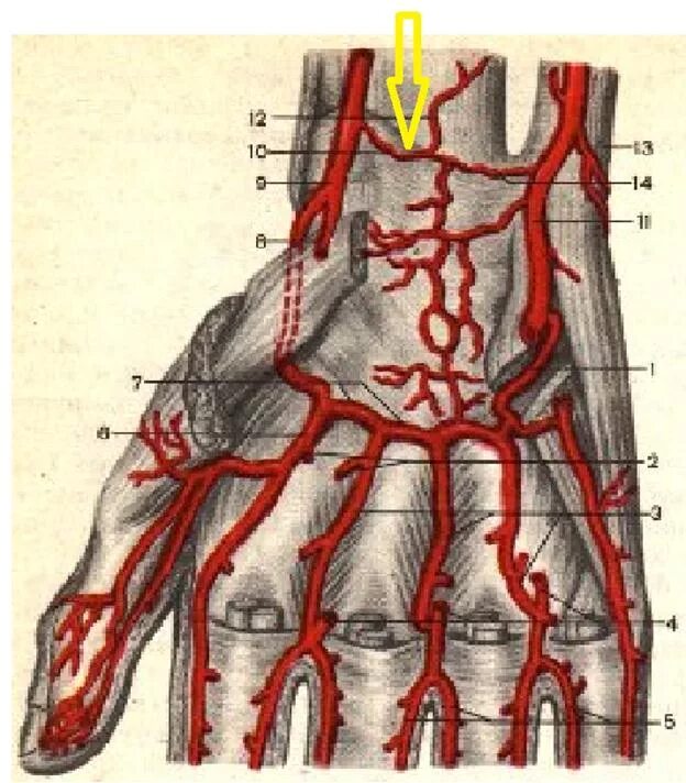 Схема глубокой ладонной дуги. Поверхностная ладонная ветвь лучевой артерии. Поверхностная ладонная дуга топография. Поверхностная дадонная душр. Артерии кисти артериальные ладонные дуги и их ветви.
