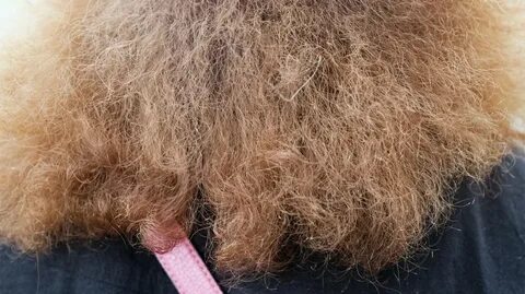 Hair but