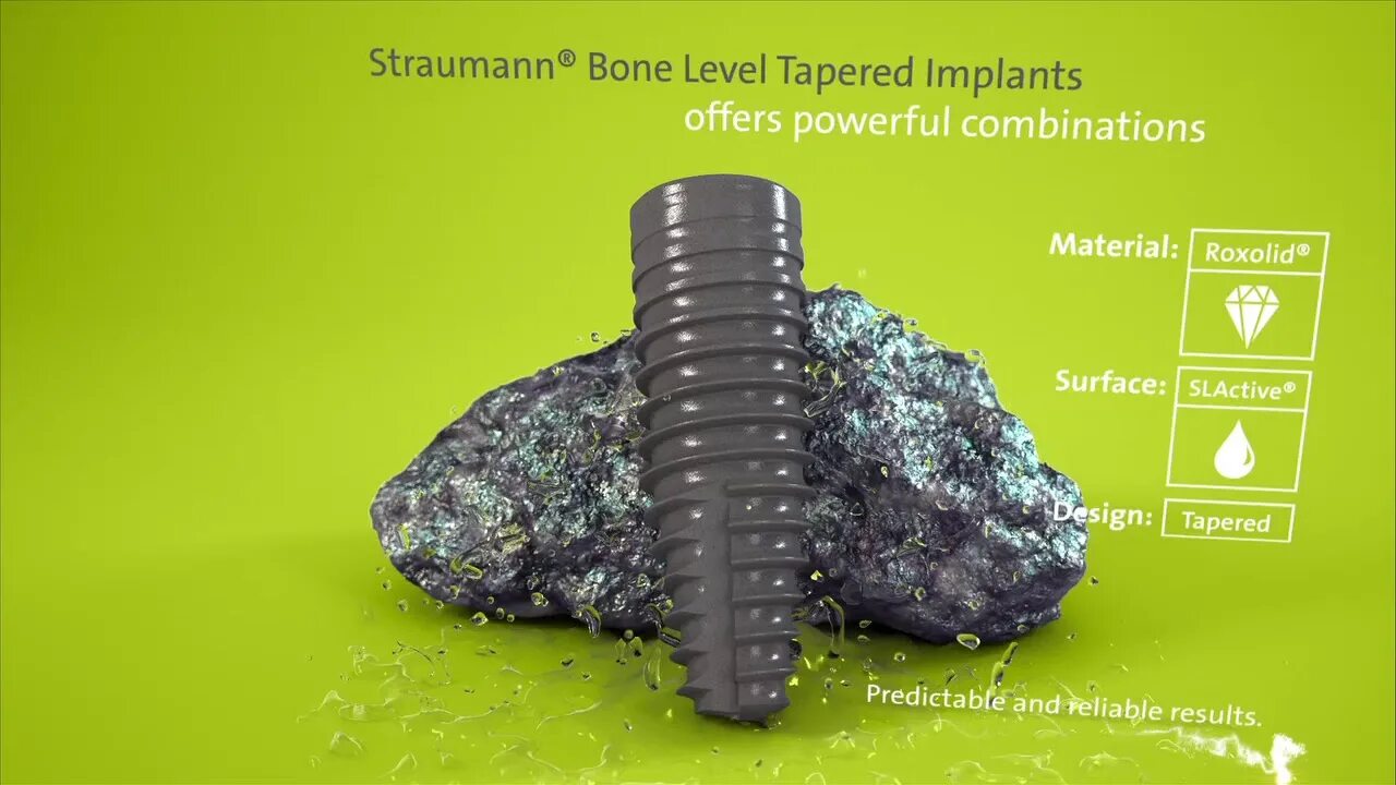 Straumann bone. Straumann bone. Straumann bone. Straumann bone level. Straumann импланты blt.