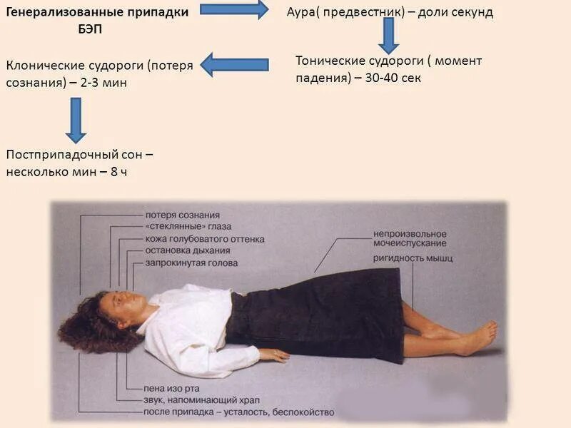 Причины припадка. Генерализованный судорожный припадок. Генерализованные припадки эпилепсии. Клонические приступы эпилепсии.