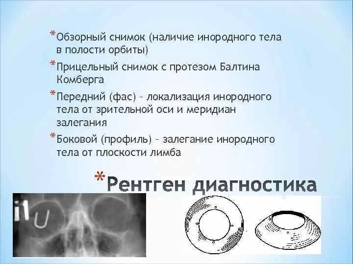 Тела карта смп. Метод Комберга Балтина. Протез Комберга-Балтина. Ренгтенлокализацтя инородно тела. Рентгенлокализация инородного тела.