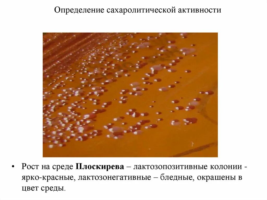 Определение сахаролитической активности. Определение сахаролитических свойств микроорганизмов. Выявление сахаролитической активности микроорганизмов. Методы определения сахаролитических свойств бактерий. Сахаролитическая активность бактерий