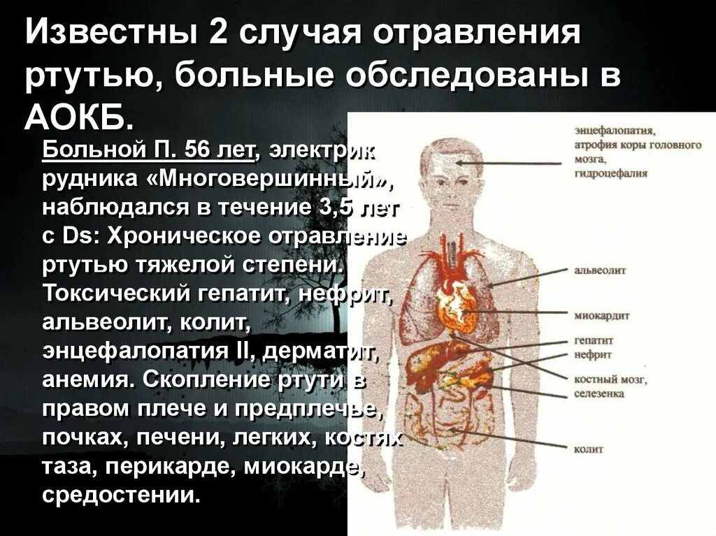 Отравление ртутью. Симптомы отравления ртутью. Отравление ртутью симптомы у человека. Симптомы острого отравления соединениями ртути:. Отравления соединениями ртути