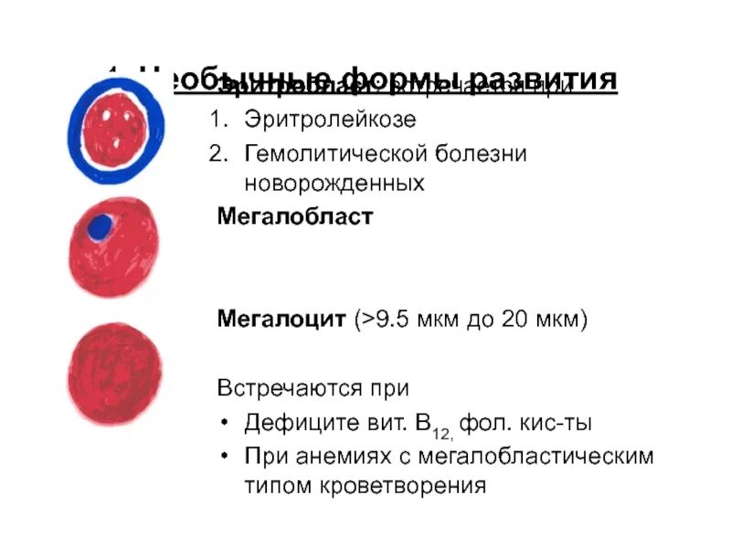 Пониженные макроциты. Мегалоциты. Мегалобласты норма в крови. Мегалобластическим типом кроветворения.