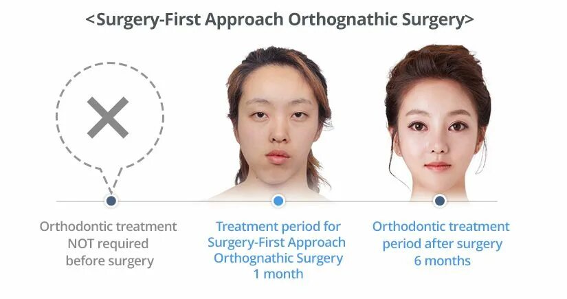 Surgery 1. Ортогнатической хирургии. Ортогнатическая хирургия схема. Ортогнатическая операция показания.