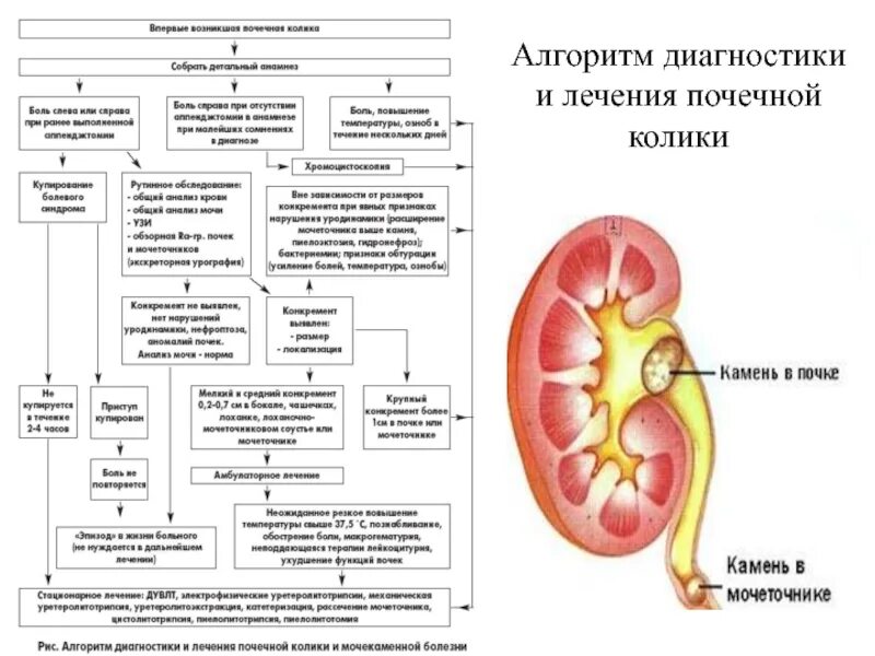 Профилактика почечной колики буклет. План лабораторного обследования больного при почечной колике. Почечная колика буклет. Почечная колика при мочекаменной болезни. Какая боль при почках у женщин симптомы