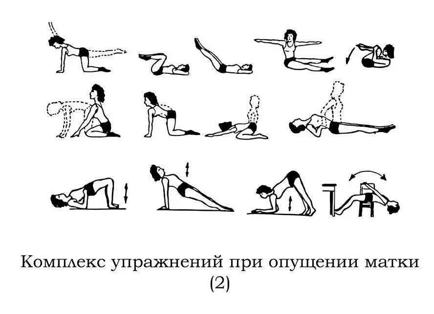 Удаление матки при опущении