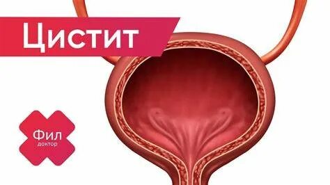 Цистит лечение форум