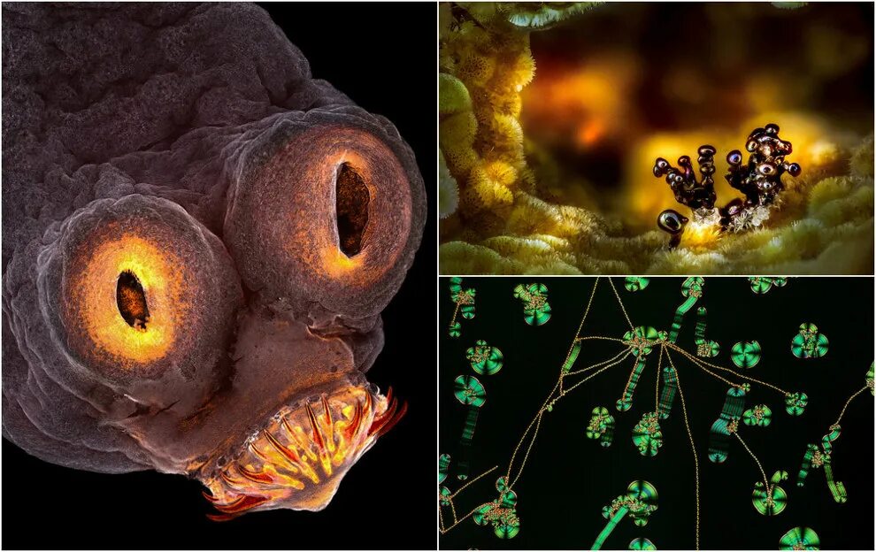 Микрофотографии Nikon small World 2017. Пластикоядные бактерии. Плотоядная бактерия под микроскопом.