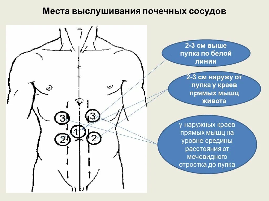 Схема болей в животе у мужчины. Точка справа от пупка. Болит левее и выше пупка. Боль выше пупка у мужчин