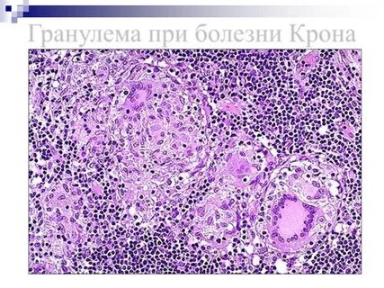 Гемикрон