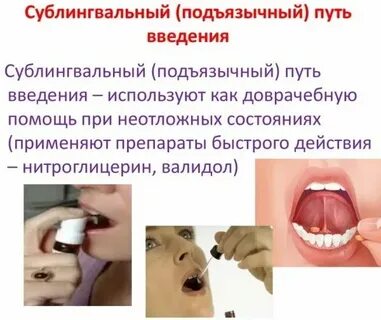 Сублингвально это как принимать таблетки взрослым