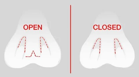 Close vs closed