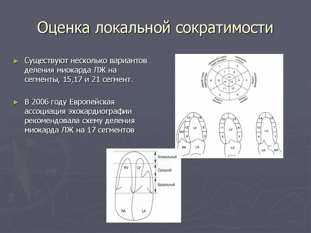 Сократимость лж. Зоны нарушения локальной сократимости. Зоны нарушения локальной сократимости миокарда схема. Оценка локальной сократимости лж. Деление миокарда на сегменты.