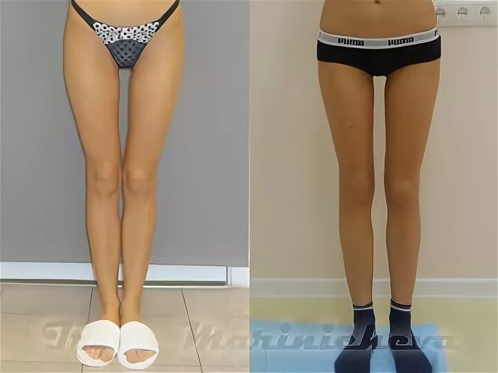 контактная сеть фд 109. фото промежуток. мадалин джорджетта. воздушный промежуток контактной сети. контактная сеть жд.