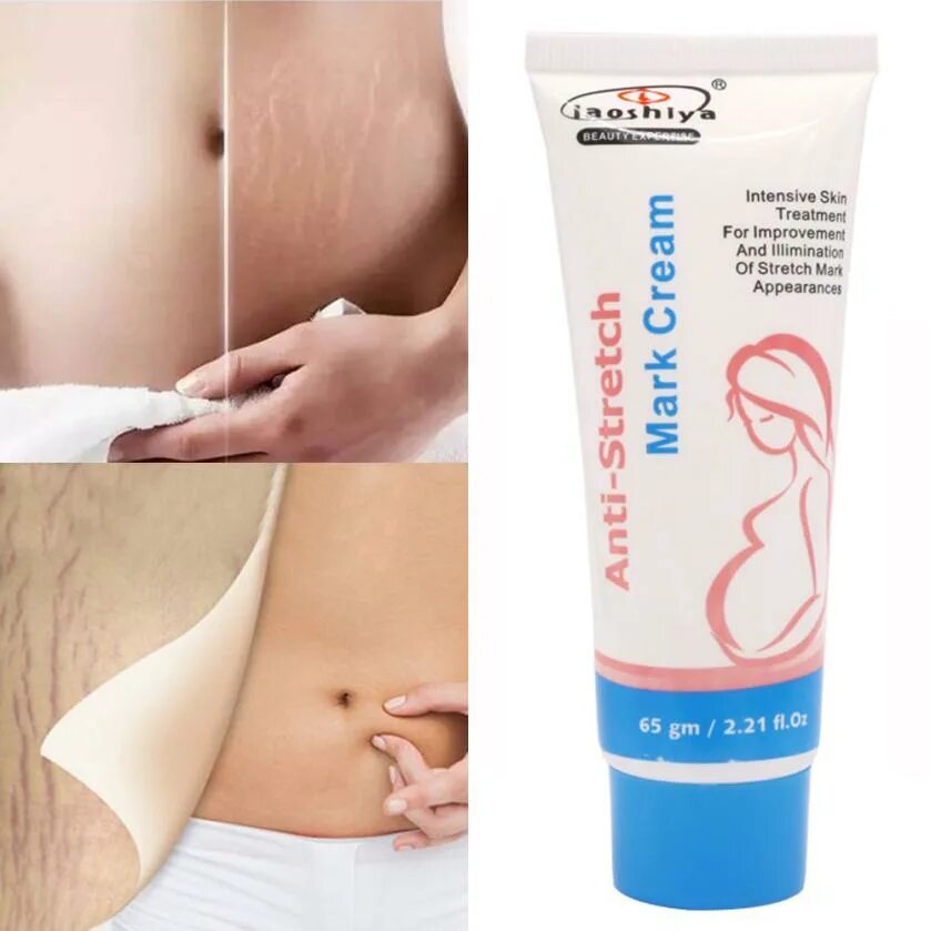 Крем от растяжек на теле. Крем против растяжек для беременных мама комфорт. Крем наша мама комфорт 0220 д/тела от растяжек 100мл. Крем от растяжек для беременных наша мама. Витекс крем от растяжек.