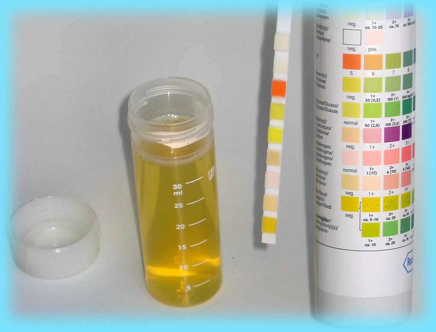 Тест полоски для мочи на белок при беременности. Тест полоски на ацетон и сахар. Ацетон в моче. Тест полоски для мочи на сахар. Мутная моча температура