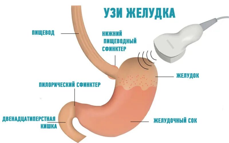 Узи желудка и кишечника