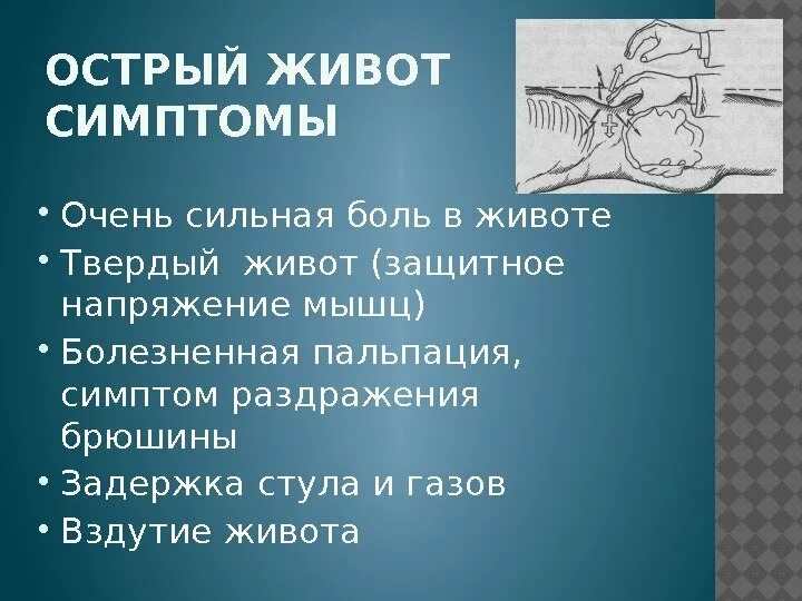 Острый живот у взрослого. Симптомы острого живота в хирургии. Понятие острый живот в хирургии. Острый живот и ложный острый живот. Симптомы острого живота пальпация.