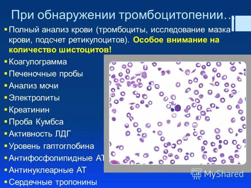 Тромбоцитопении тест