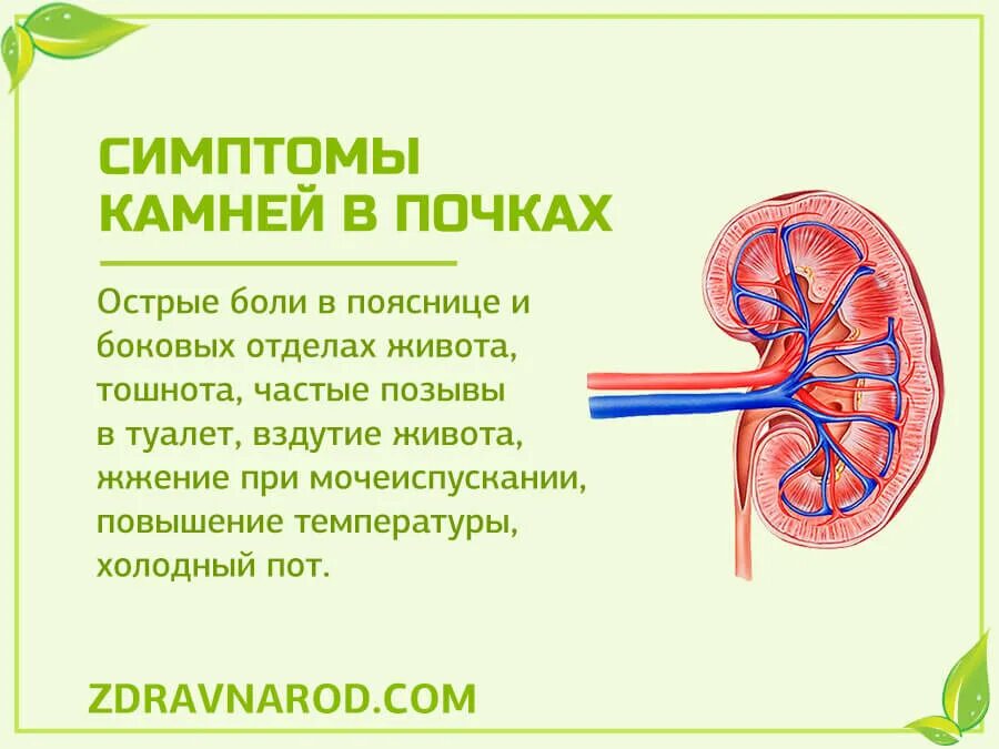 Камень выходит из почки симптомы у мужчин. Камни в почках симптомы у мужчин симптомы. камни в посках симптом. камнитв почках симптомы.
