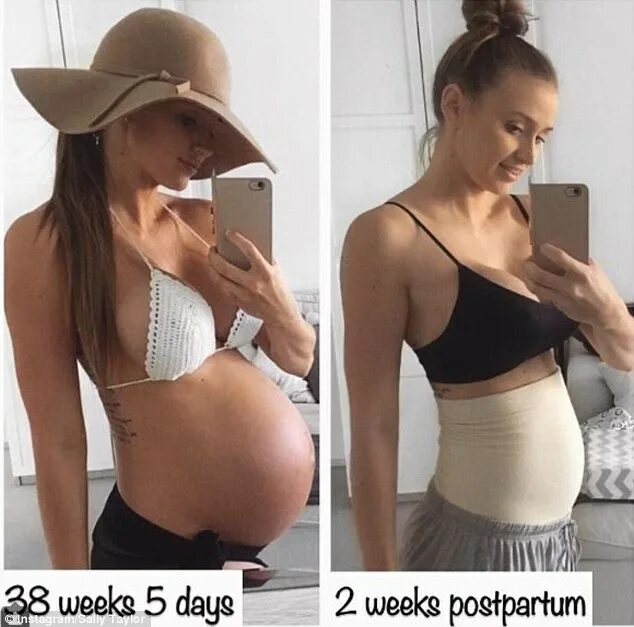 Через сколько месяцев после родов. Живот после рождения ребенка. До и после беременности.