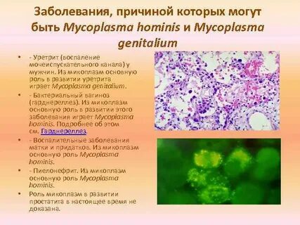Микоплазмоз у женщин симптомы и причины